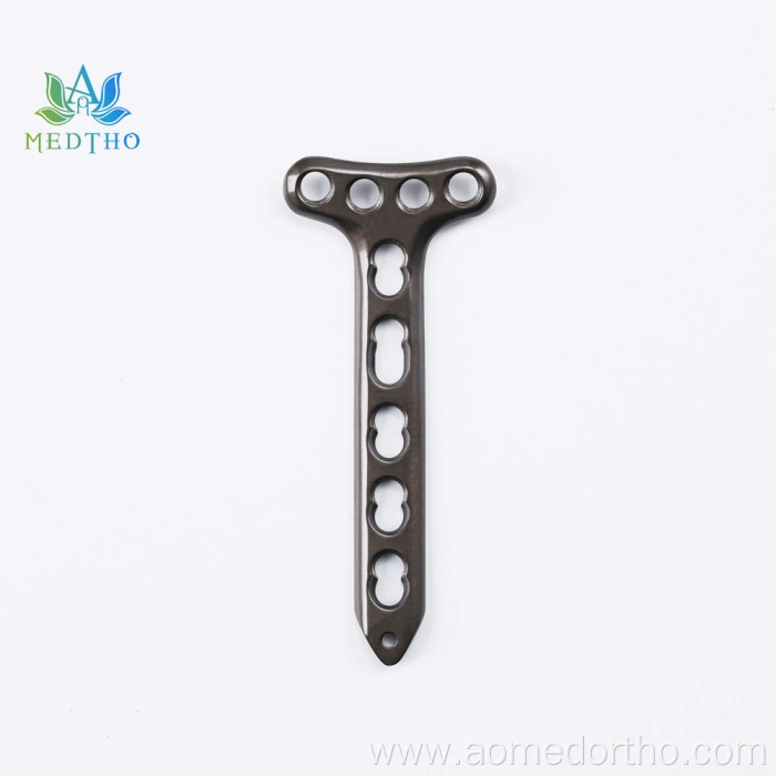 distal radius plate
